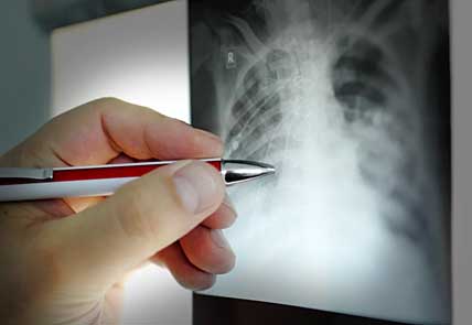 РЕНТГЕН И ЭКГ С ДОСТАВКОЙ НА ДОМ